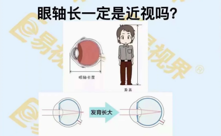 眼軸長一定是近視嗎？